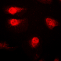 CDKN1B / p27 Kip1 Antibody - Immunofluorescent analysis of p27 Kip1 (pT187) staining in A431 cells. Formalin-fixed cells were permeabilized with 0.1% Triton X-100 in TBS for 5-10 minutes and blocked with 3% BSA-PBS for 30 minutes at room temperature. Cells were probed with the primary antibody in 3% BSA-PBS and incubated overnight at 4 C in a humidified chamber. Cells were washed with PBST and incubated with a DyLight 594-conjugated secondary antibody (red) in PBS at room temperature in the dark. DAPI was used to stain the cell nuclei (blue).