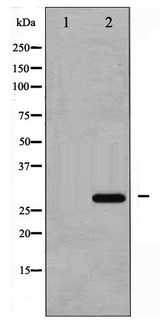 CDKN1B / p27 Kip1 Antibody - Western blot of p27 Kip1 phosphorylation expression in EGF treated HeLa whole cell lysates,The lane on the left is treated with the antigen-specific peptide.