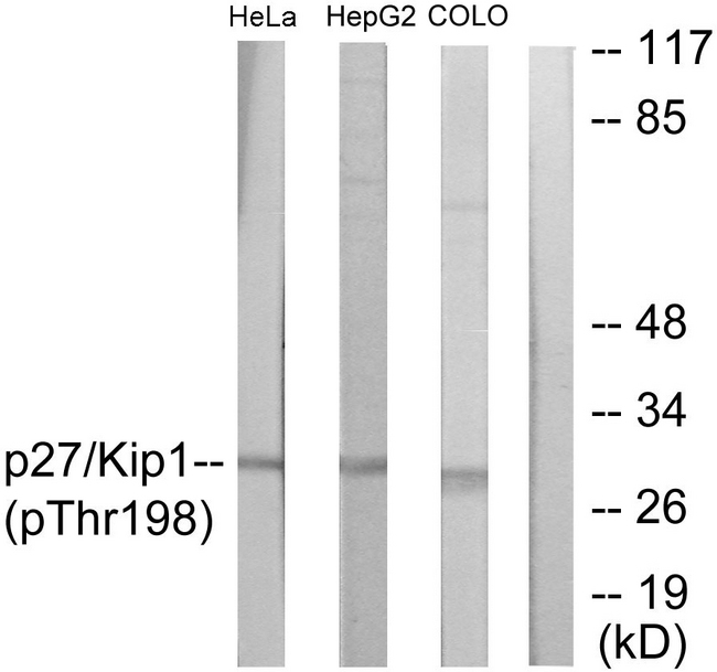 CDKN1B / p27 Kip1 Antibody - Western blot analysis of lysates from HeLa cells, HepG2 cells and COLO cells, using p27 Kip1 (Phospho-Thr198) Antibody. The lane on the right is blocked with the phospho peptide.