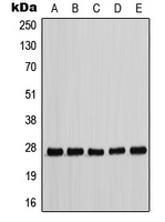 CDKN1B / p27 Kip1 Antibody - Western blot analysis of p27 Kip1 (pT198) expression in HEK293T EGF-treated (A); MCF7 (B); NIH3T3 (C); Raw264.7 EGF-treated (D); H9C2 EGF-treated (E) whole cell lysates.