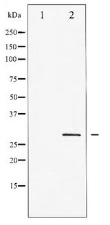 CDKN1B / p27 Kip1 Antibody - Western blot of p27 Kip1 phosphorylation expression in HeLa whole cell lysates,The lane on the left is treated with the antigen-specific peptide.