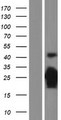 CDKN1B / p27 Kip1 Protein - Western validation with an anti-DDK antibody * L: Control HEK293 lysate R: Over-expression lysate