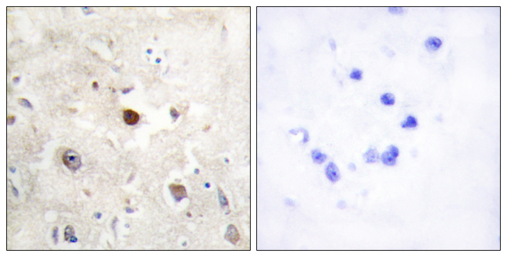 CDKN1C / p57 Kip2 Antibody - Immunohistochemistry analysis of paraffin-embedded human brain, using p57KIP2 Antibody. The picture on the right is blocked with the synthesized peptide.