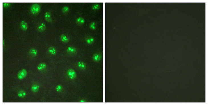 CDKN1C / p57 Kip2 Antibody - Immunofluorescence analysis of HUVEC cells, using p57 Kip2 Antibody. The picture on the right is blocked with the synthesized peptide.