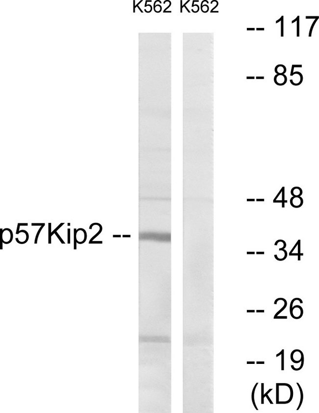 CDKN1C / p57 Kip2 Antibody - Western blot analysis of lysates from K562 cells, using p57 Kip2 Antibody. The lane on the right is blocked with the synthesized peptide.