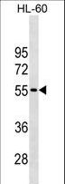 CDKN1C / p57 Kip2 Antibody - CDKN1C Antibody western blot of HL-60 cell line lysates (35 ug/lane). The CDKN1C antibody detected the CDKN1C protein (arrow).