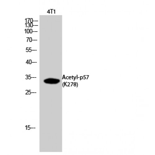 CDKN1C / p57 Kip2 Antibody - Western blot of Acetyl-p57 (K278) antibody