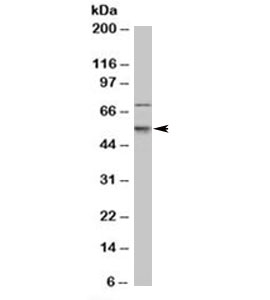 CDKN1C / p57 Kip2 Antibody - Western blot testing of human Jurkat cell lysate with p57Kip2 antibody (clone 57P06). This image was taken for the unmodified form of this product. Other forms have not been tested.