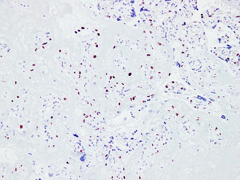 CDKN1C / p57 Kip2 Antibody - Placenta 1