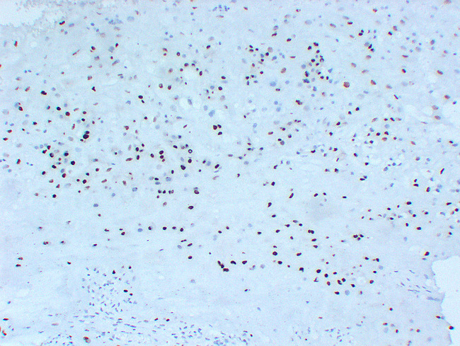 CDKN1C / p57 Kip2 Antibody - Placenta 2