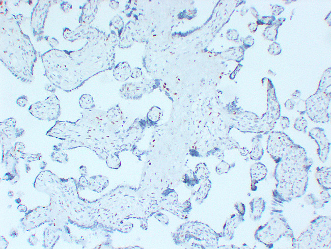 CDKN1C / p57 Kip2 Antibody - Placenta 3