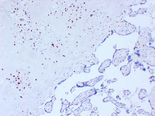 CDKN1C / p57 Kip2 Antibody - Placenta 4