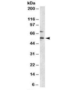 CDKN1C / p57 Kip2 Antibody - Western blot testing of human Jurkat cell lysate with p57 antibody (clone KP10). This image was taken for the unmodified form of this product. Other forms have not been tested.