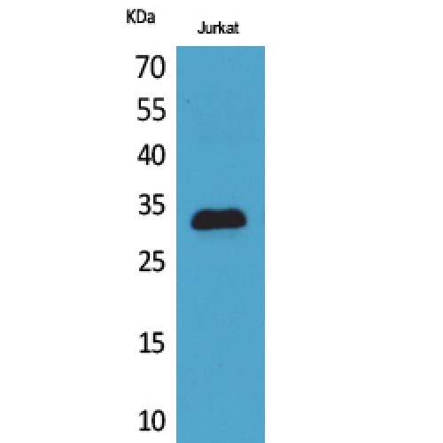 CDKN1C / p57 Kip2 Antibody - Western blot of p57 antibody