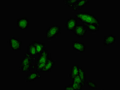 CDKN1C / p57 Kip2 Antibody - Immunofluorescent analysis of Hela cells at a dilution of 1:100 and Alexa Fluor 488-congugated AffiniPure Goat Anti-Rabbit IgG(H+L)