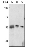 CDKN1C / p57 Kip2 Antibody - Western blot analysis of p57 Kip2 (pT310) expression in K562 (A), Hela (B), HEK293T (C) whole cell lysates.
