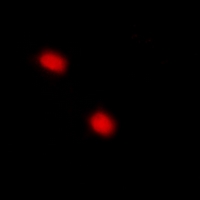 CDKN1C / p57 Kip2 Antibody - Immunofluorescent analysis of p57 Kip2 (pT310) staining in HuvEc cells. Formalin-fixed cells were permeabilized with 0.1% Triton X-100 in TBS for 5-10 minutes and blocked with 3% BSA-PBS for 30 minutes at room temperature. Cells were probed with the primary antibody in 3% BSA-PBS and incubated overnight at 4 °C in a hidified chamber. Cells were washed with PBST and incubated with Alexa Fluor 647-conjugated secondary antibody (red) in PBS at room temperature in the dark.