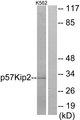CDKN1C / p57 Kip2 Antibody - Western blot analysis of extracts from K562 cells, using p57 Kip2 (Ab-310) antibody.