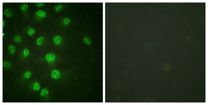 CDKN1C / p57 Kip2 Antibody - Immunofluorescence analysis of HUVEC cells treated with serum 20% 30', using p57 Kip2 (Phospho-Thr310) Antibody. The picture on the right is blocked with the phospho peptide.