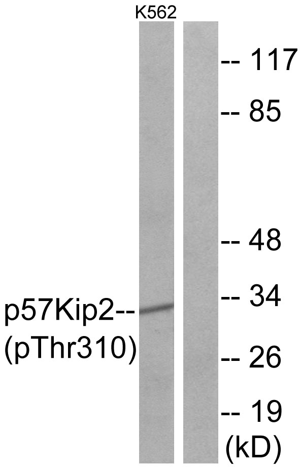 CDKN1C / p57 Kip2 Antibody - Western blot analysis of lysates from K562 cells treated with insulin 0.01U/ml 15', using p57 Kip2 (Phospho-Thr310) Antibody. The lane on the right is blocked with the phospho peptide.