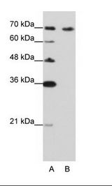 CDKN2AIP Antibody - A: Marker, B: Jurkat Cell Lysate.  This image was taken for the unconjugated form of this product. Other forms have not been tested.