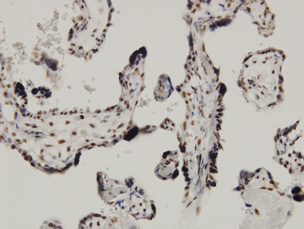 CDKN2AIP Antibody - Immunoperoxidase of monoclonal antibody to CARF on formalin-fixed paraffin-embedded human placenta. [antibody concentration 3 ug/ml]