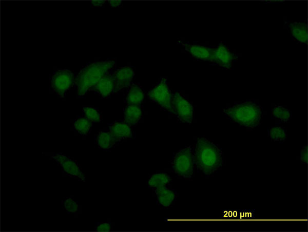 CDKN2AIP Antibody - Immunofluorescence of monoclonal antibody to CARF on HeLa cell. [antibody concentration 10 ug/ml]