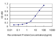 CDKN2AIP Antibody - Detection limit for recombinant GST tagged CARF is approximately 1 ng/ml as a capture antibody.