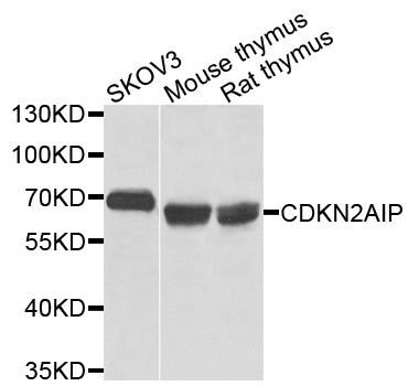 CDKN2AIP Antibody - Western blot analysis of extracts of various cells.
