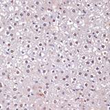 CDKN2AIP Antibody - Immunohistochemistry of paraffin-embedded Rat liver using CDKN2A / p16INK4a Polyclonal Antibody at dilution of 1:100 (40x lens).