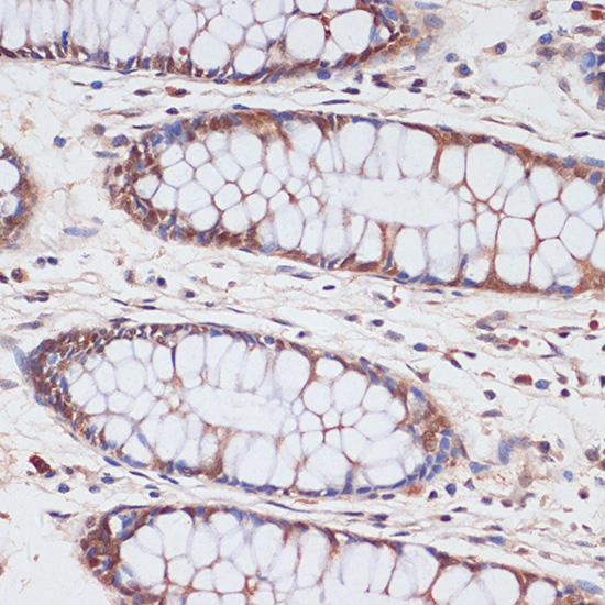CDKN2AIP Antibody - Immunohistochemistry of paraffin-embedded Human colon using CDKN2A / p16INK4a Polyclonal Antibody at dilution of 1:100 (40x lens).