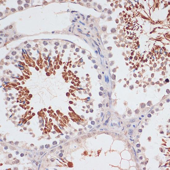 CDKN2AIP Antibody - Immunohistochemistry of paraffin-embedded Mouse testis using CDKN2A / p16INK4a Polyclonal Antibody at dilution of 1:100 (40x lens).
