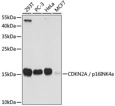 CDKN2AIP Antibody - Western blot analysis of extracts of various cell lines using CDKN2A / p16INK4a Polyclonal Antibody at dilution of 1:1000.