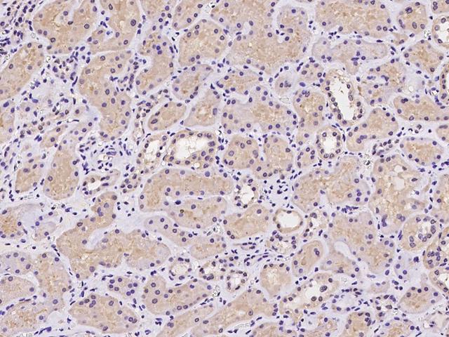 CDKN2AIPNL Antibody - Immunochemical staining of human CDKN2AIPNL in human kidney with rabbit polyclonal antibody at 1:100 dilution, formalin-fixed paraffin embedded sections.