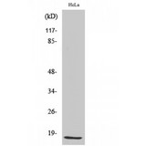 CDKN2B / p15 INK4b Antibody - Western blot of p15 antibody