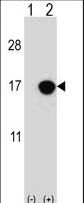 CDKN2B / p15 INK4b Antibody - Western blot of CDKN2B (arrow) using rabbit polyclonal CDKN2B Antibody. 293 cell lysates (2 ug/lane) either nontransfected (Lane 1) or transiently transfected (Lane 2) with the CDKN2B gene.