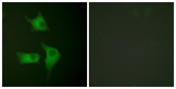 CDKN2B / p15 INK4b Antibody - Immunofluorescence analysis of HeLa cells, using p15 INK Antibody. The picture on the right is blocked with the synthesized peptide.