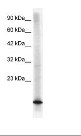 CDKN2B / p15 INK4b Antibody - HepG2 Cell Lysate.  This image was taken for the unconjugated form of this product. Other forms have not been tested.