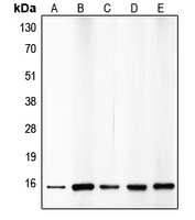 CDKN2B / p15 INK4b Antibody - Western blot analysis of p15 INK4b expression in HepG2 (A); A549 (B); HeLa (C); mouse brain (D); rat kidney (E) whole cell lysates.