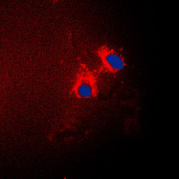 CDKN2B / p15 INK4b Antibody - Immunofluorescent analysis of p15 INK4b staining in A549 cells. Formalin-fixed cells were permeabilized with 0.1% Triton X-100 in TBS for 5-10 minutes and blocked with 3% BSA-PBS for 30 minutes at room temperature. Cells were probed with the primary antibody in 3% BSA-PBS and incubated overnight at 4 C in a humidified chamber. Cells were washed with PBST and incubated with a DyLight 594-conjugated secondary antibody (red) in PBS at room temperature in the dark. DAPI was used to stain the cell nuclei (blue).
