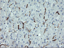 CDKN2B / p15 INK4b Antibody - IHC of paraffin-embedded Human liver tissue using anti-CDKN2B mouse monoclonal antibody.