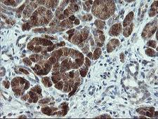 CDKN2B / p15 INK4b Antibody - IHC of paraffin-embedded Human pancreas tissue using anti-CDKN2B mouse monoclonal antibody.