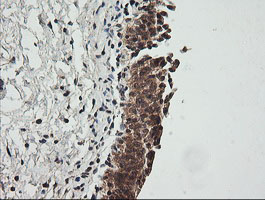CDKN2B / p15 INK4b Antibody - IHC of paraffin-embedded Human bladder tissue using anti-CDKN2B mouse monoclonal antibody.
