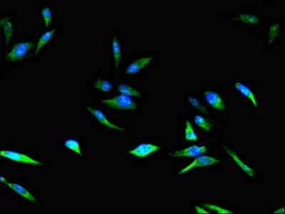 CDKN2B / p15 INK4b Antibody - Immunofluorescent analysis of Hela cells using CDKN2B Antibody at dilution of 1:100 and Alexa Fluor 488-congugated AffiniPure Goat Anti-Rabbit IgG(H+L)