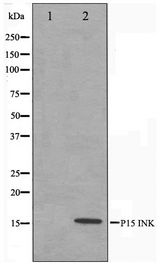 CDKN2B / p15 INK4b Antibody - Western blot of HeLa cell lysate using p15 INK Antibody