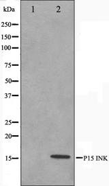 CDKN2B / p15 INK4b Antibody - Western blot analysis on HeLa cell lysates using p15 INK antibody. The lane on the left is treated with the antigen-specific peptide.