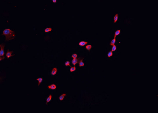 CDKN2B / p15 INK4b Antibody - Staining HeLa cells by IF/ICC. The samples were fixed with PFA and permeabilized in 0.1% Triton X-100, then blocked in 10% serum for 45 min at 25°C. The primary antibody was diluted at 1:200 and incubated with the sample for 1 hour at 37°C. An Alexa Fluor 594 conjugated goat anti-rabbit IgG (H+L) Ab, diluted at 1/600, was used as the secondary antibody.