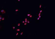 CDKN2B / p15 INK4b Antibody - Staining HeLa cells by IF/ICC. The samples were fixed with PFA and permeabilized in 0.1% Triton X-100, then blocked in 10% serum for 45 min at 25°C. The primary antibody was diluted at 1:200 and incubated with the sample for 1 hour at 37°C. An Alexa Fluor 594 conjugated goat anti-rabbit IgG (H+L) Ab, diluted at 1/600, was used as the secondary antibody.