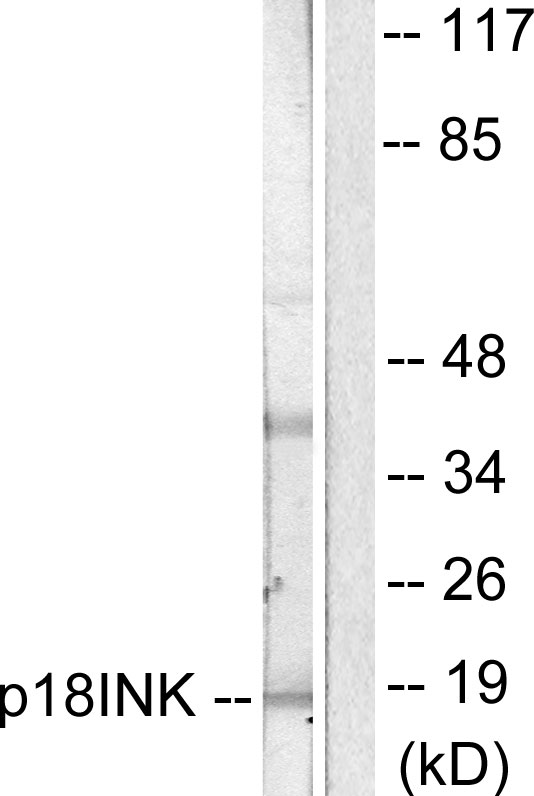 CDKN2C / p18 INK4c Antibody - Western blot analysis of lysates from COS7 cells, using p18 INK Antibody. The lane on the right is blocked with the synthesized peptide.