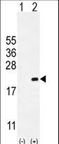 CDKN2C / p18 INK4c Antibody - Western blot of CDKN2C (arrow) using rabbit polyclonal CDKN2C Antibody. 293 cell lysates (2 ug/lane) either nontransfected (Lane 1) or transiently transfected (Lane 2) with the CDKN2C gene.